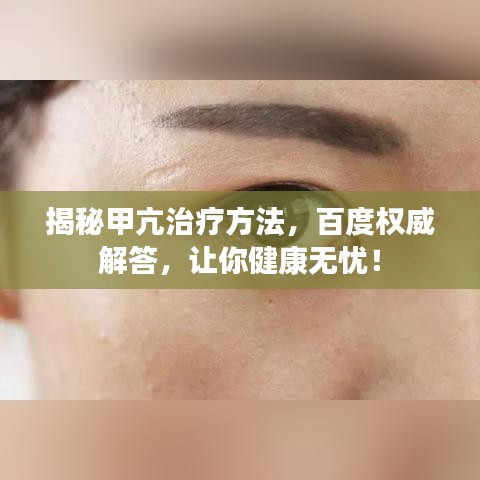 揭秘甲亢治療方法，百度權(quán)威解答，讓你健康無(wú)憂！