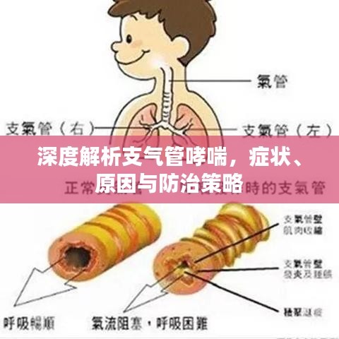 深度解析支氣管哮喘，癥狀、原因與防治策略