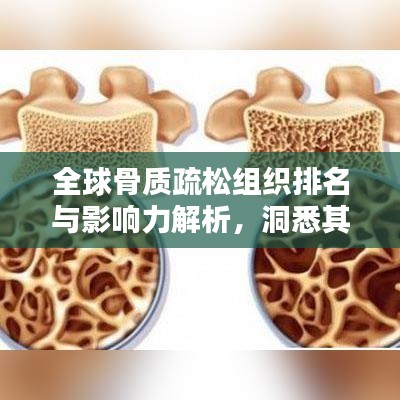 全球骨質(zhì)疏松組織排名與影響力解析，洞悉其在世界舞臺上的位置