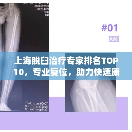 上海脫臼治療專家排名TOP10，專業(yè)復(fù)位，助力快速康復(fù)
