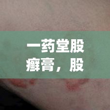 一藥堂股癬膏，股癬的克星，專業(yè)解決方案