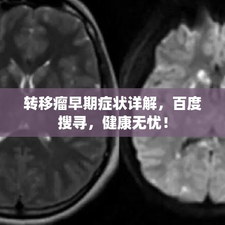 轉(zhuǎn)移瘤早期癥狀詳解，百度搜尋，健康無憂！